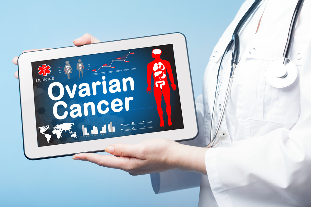 ovarian cancer.jpg